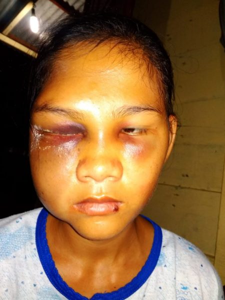 Pelaku Penganiayaan Dan Pencabulan Tidak Ditahan