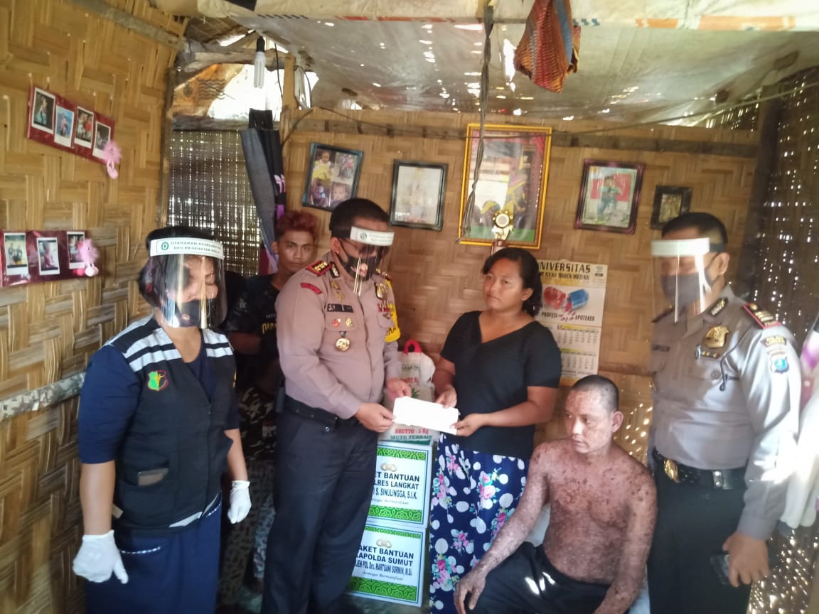 Kabid Humas Polda Sumut : Kapolres Langkat Serahkan Bantuan Dari Kapolda Sumut Kepada Nano