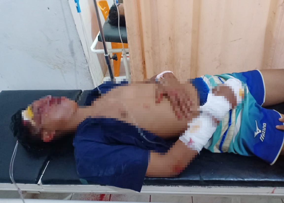 Polsek Rawa Jitu Selatan Identifikasi dan Olah TKP Peristiwa Laka Lantas, Satu MD dan Dua Kritis